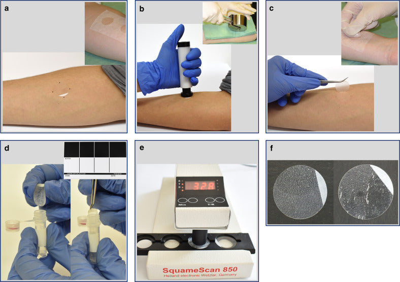 Research Techniques Made Simple: Stratum Corneum Tape Stripping