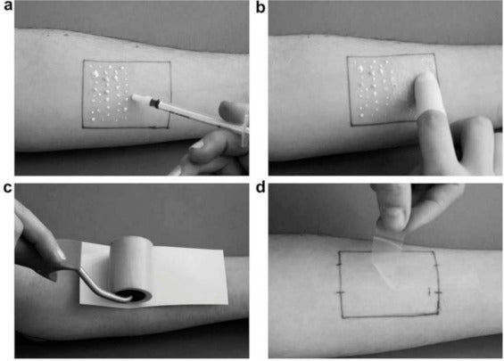 Tape stripping: investigational, diagnostic, and therapeutic uses in dermatology
