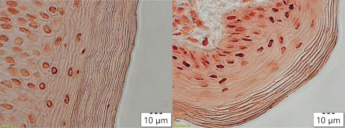 Continuous removal of single cell layers by tape stripping the stratum corneum