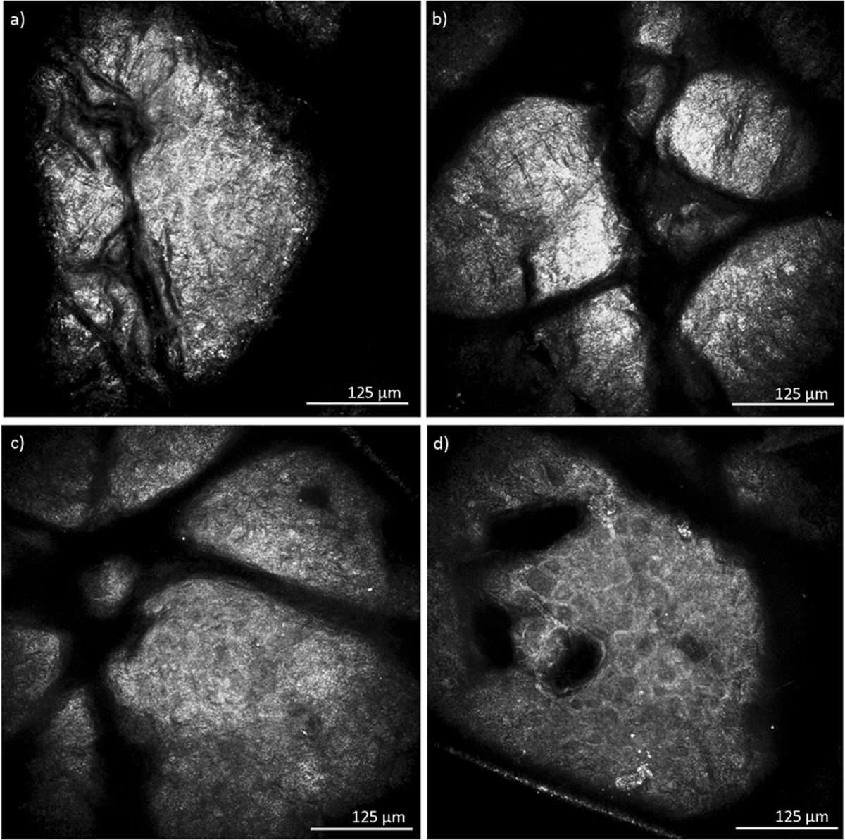 Advancement through epidermis using tape stripping technique and Reflectance Confocal Microscopy
