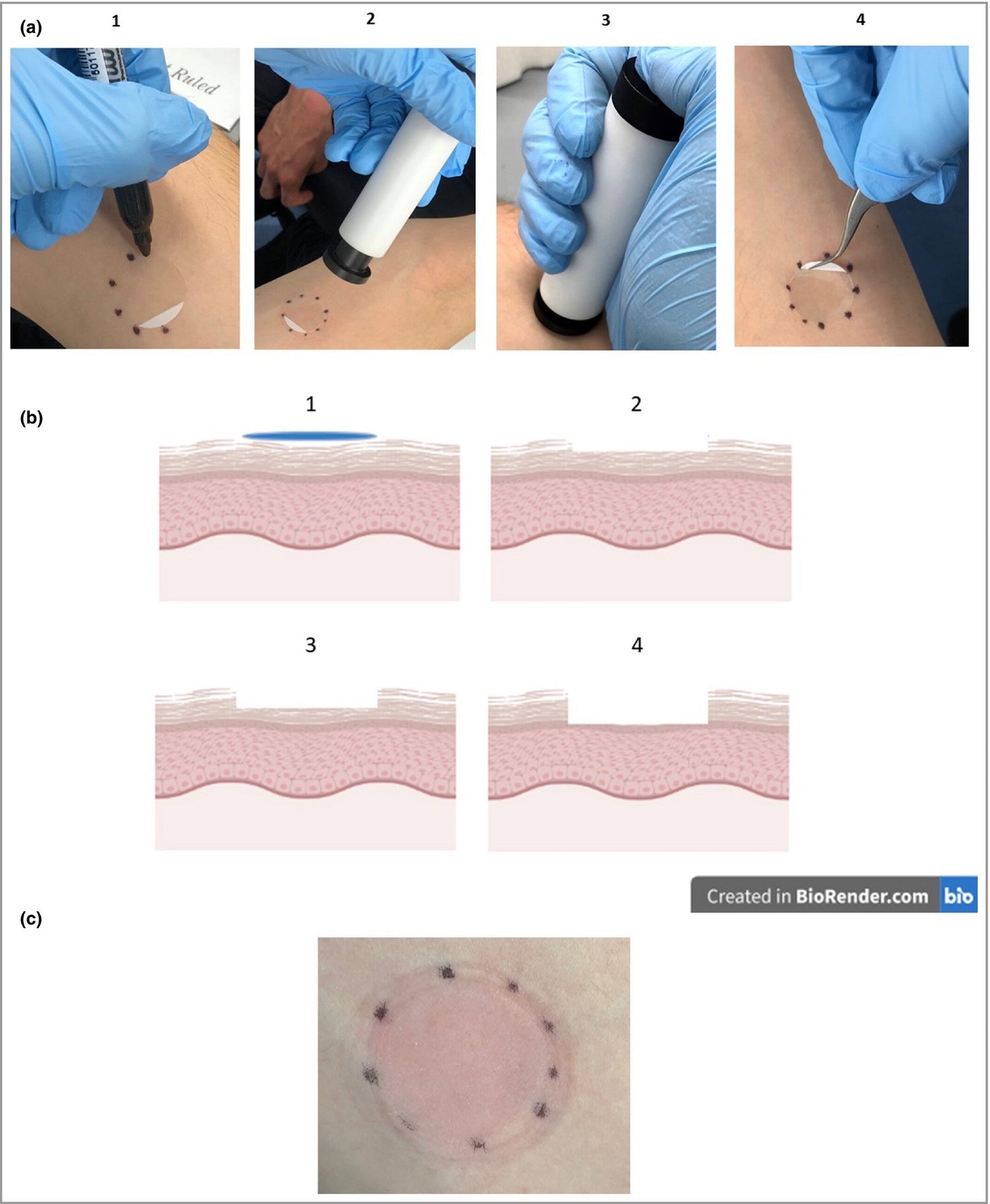Tape strips in dermatology research